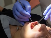 ¿Qué es la periodontitis?